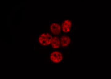 NBN / Nibrin Antibody