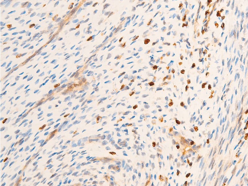 Polyclonal Rabbit anti-Human SYK Antibody (phospho-Tyr323, IHC, IF, WB)
