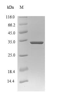 Human SCAND1 Protein (Recombinant GST, N-terminus)