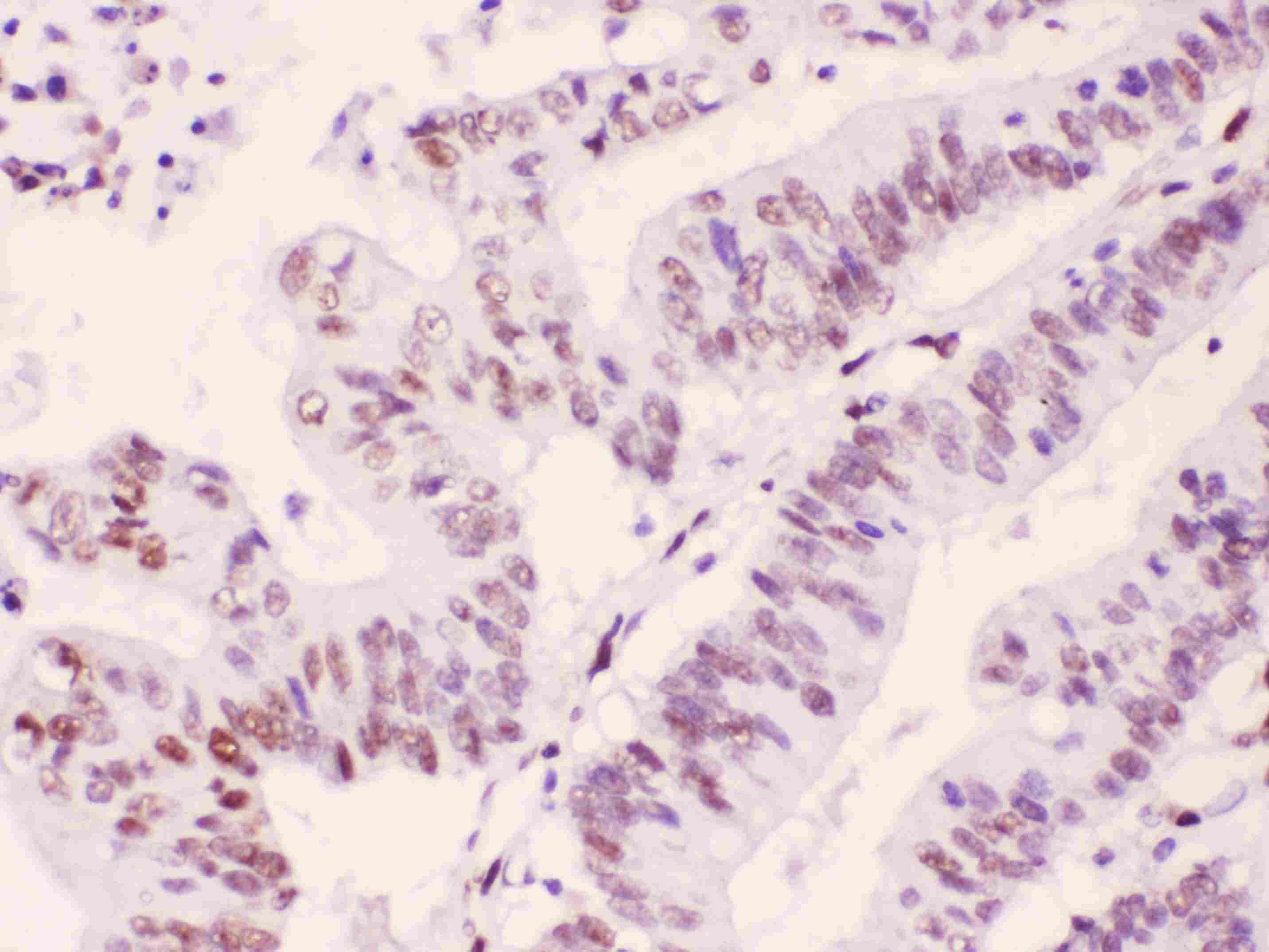 Polyclonal Rabbit anti-Human PML Antibody (IHC, WB)