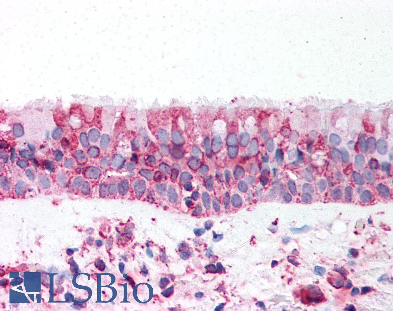 IHC-plus™ TRPV4 Antibody (N-Terminus)
