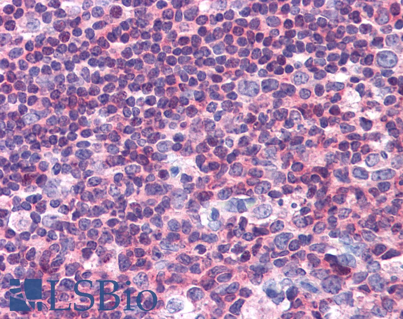 IHC-plus™ PTK2B / PYK2 Antibody (clone 5E2D5)