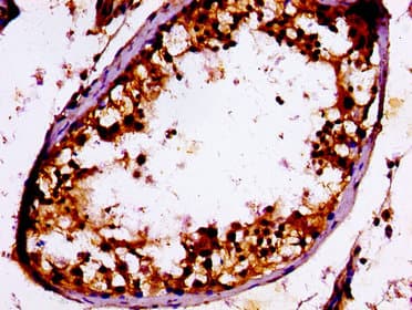 RPS7 / Ribosomal Protein S7 Antibody