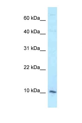 Polyclonal Rabbit anti-Human DAP Antibody (C-Terminus, WB)
