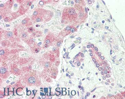 SPRY2 / Sprouty 2 Antibody (Internal)