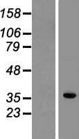 MAP1D Protein (Over-Expression Lysate Myc-DDK (Flag))