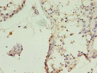 TIMM10B / FXC1 Antibody