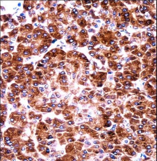 Polyclonal Rabbit anti-Human US01 / p115 Antibody (aa932-960, IHC, WB)