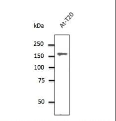 Polyclonal Goat anti-Human CLTC / Clathrin Heavy Chain Antibody (N-Terminus, IF, WB)