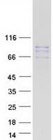 Human TSGA10 Protein (Recombinant Myc-DDK (Flag))