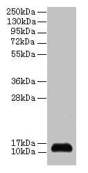 IHC-plus™ Polyclonal Rabbit anti-Human SNRPD2 Antibody (IHC, WB)