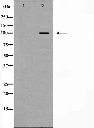 CTNNA1 / Catenin Alpha-1 Antibody