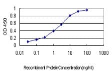 RNF139 / TRC8 Antibody (clone 3D10)