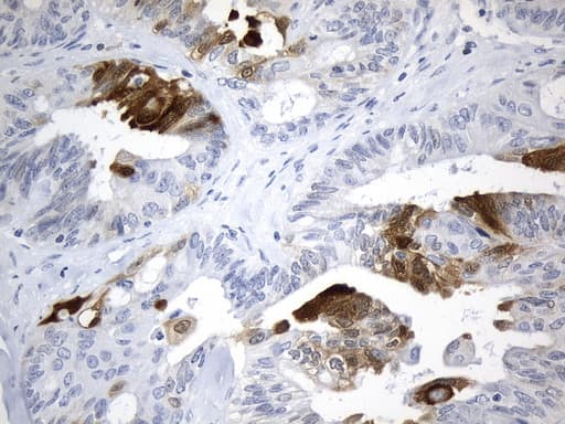 IDO1 / IDO Antibody (clone UMAB252)