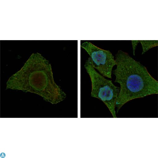 BRAF / B-Raf Antibody