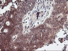 RFXANK Antibody (clone OTI3E7, Carrier-free)