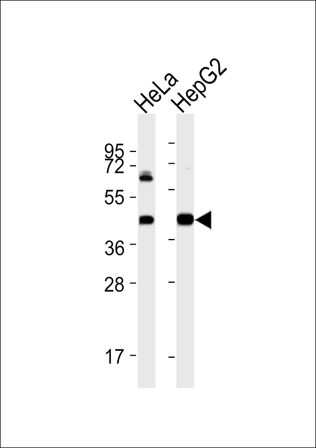 ACAT1 Antibody