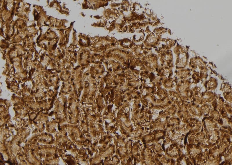 RPL17 / Ribosomal Protein L17 Antibody