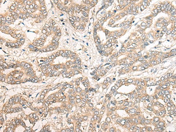 PCDHGB5 Antibody