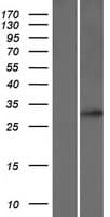 RAB34 Protein (Over-Expression Lysate Myc-DDK (Flag))