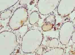 Polyclonal Rabbit anti-Human DHRS3 / SDR1 Antibody (IHC, WB)