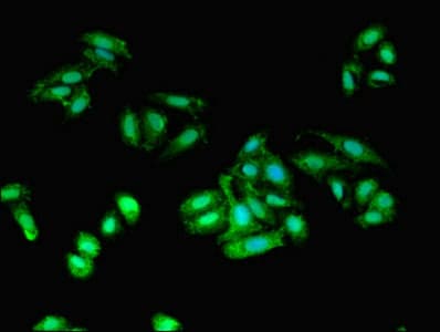 AIF1 / IBA1 Antibody (aa2-147)