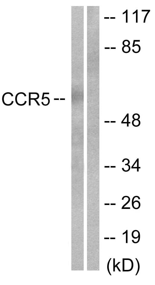 Polyclonal Rabbit anti-Human CCR5 Antibody (p349, WB)