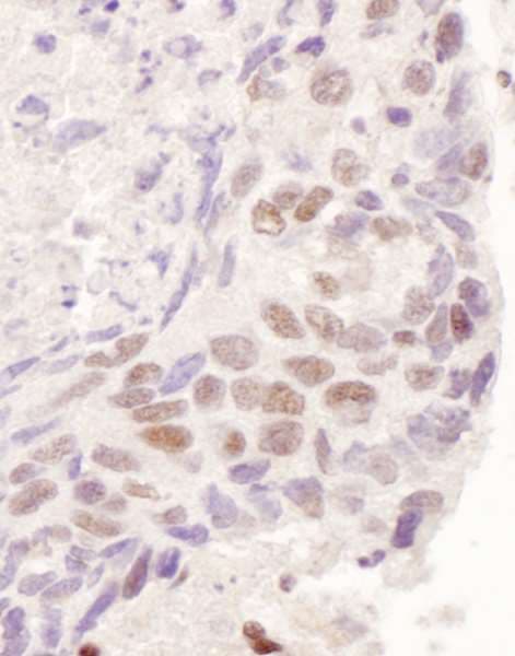Polyclonal Rabbit anti-Human NR3C1/Glucocorticoid Receptor Antibody (aa1-50, IHC, WB)