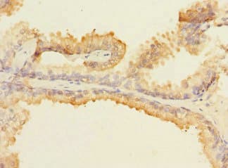 Polyclonal Rabbit anti-Human MAP4K5 Antibody (IHC, WB)