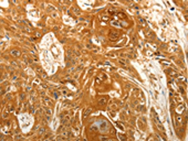 VILIP / VSNL1 Antibody