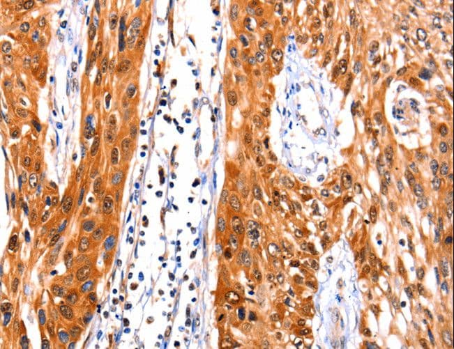 FBLN1 / Fibulin 1 Antibody