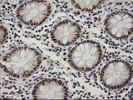 LOX / Lysyl Oxidase Antibody (clone OTI9G2)