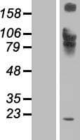IL12RB1 / CD212 Protein (Over-Expression Lysate Myc-DDK (Flag))