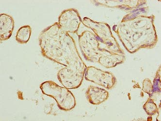 CAPN6 / Calpain 6 Antibody