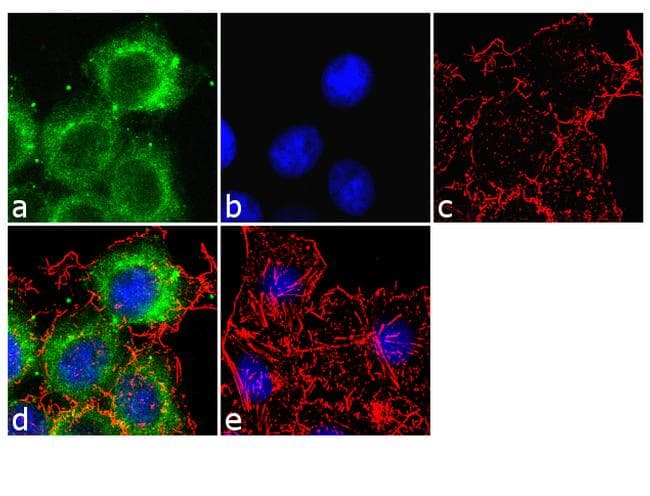 APOB / Apolipoprotein B Antibody (clone F2C4)