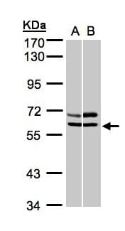 Polyclonal Rabbit anti-Human PRKAA2 / AMPK Alpha 2 Antibody (aa29-510, IHC, WB)