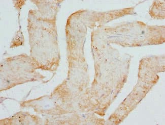 CSRP3 Antibody