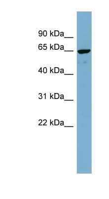NOP58 / NOP5 Antibody (aa395-444)
