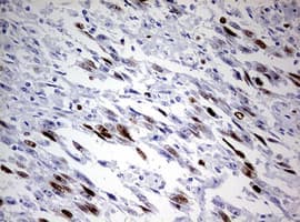 TOP2A / Topoisomerase II Alpha Antibody (aa1100-1531, clone 1D2, Carrier-free)