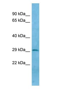 TREML1 / TLT1 Antibody (C-Terminus)