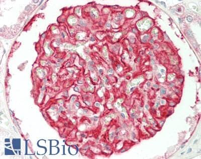 IHC-plus™ ITGA3 / CD49c Antibody (aa482-531)