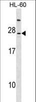 LY96 / MD2 / MD-2 Antibody (aa103-132)