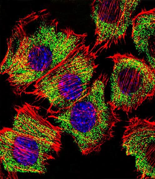 IHC-plus™ Polyclonal Rabbit anti-Human ENO1 / Alpha Enolase Antibody (aa178-205, IHC, IF, WB)