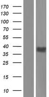 GPR17 Protein (Over-Expression Lysate Myc-DDK (Flag))