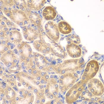 Polyclonal Rabbit anti-Human PIP4K2A / PIPK Antibody (IHC, IF, WB)