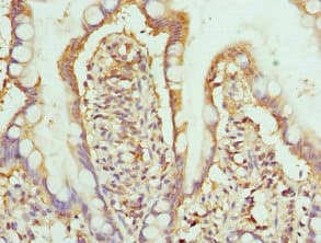 HPS / HPS1 Antibody