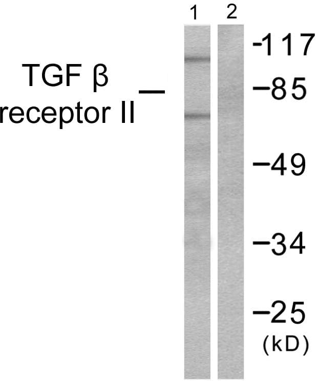 TGFBR2 Antibody