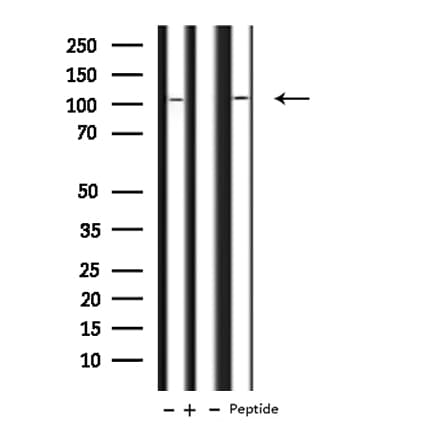 Polyclonal Rabbit anti-Human NUP107 Antibody (WB)