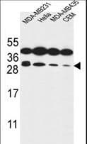 Polyclonal Rabbit anti-Human STX10 / Syntaxin 10 Antibody (aa60-89, WB)