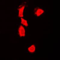 TP53 / p53 Antibody (C-Terminus)